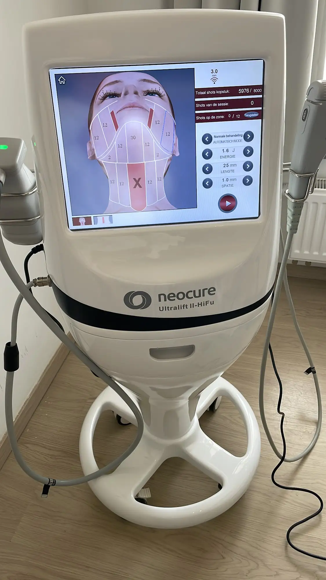 Professioneel HIFU apparaat met facial mapping interface in de behandelkamer